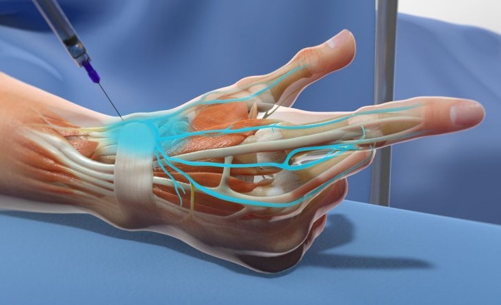Sinir Blokajı Uygulamaları