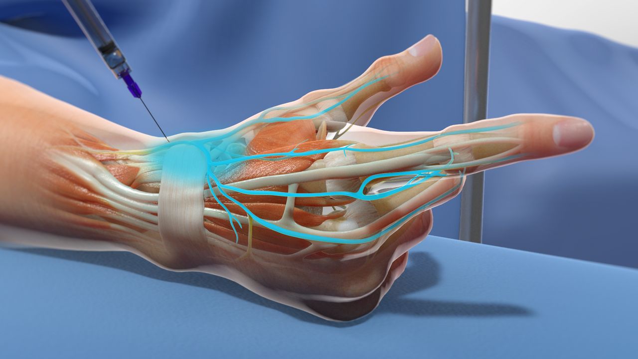 Sinir Blokajı Uygulamaları